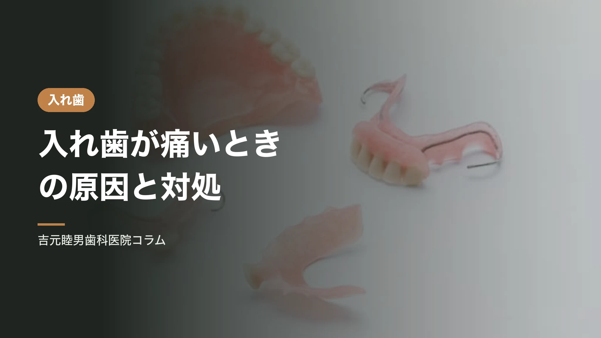 入れ歯が痛いときの原因と対処