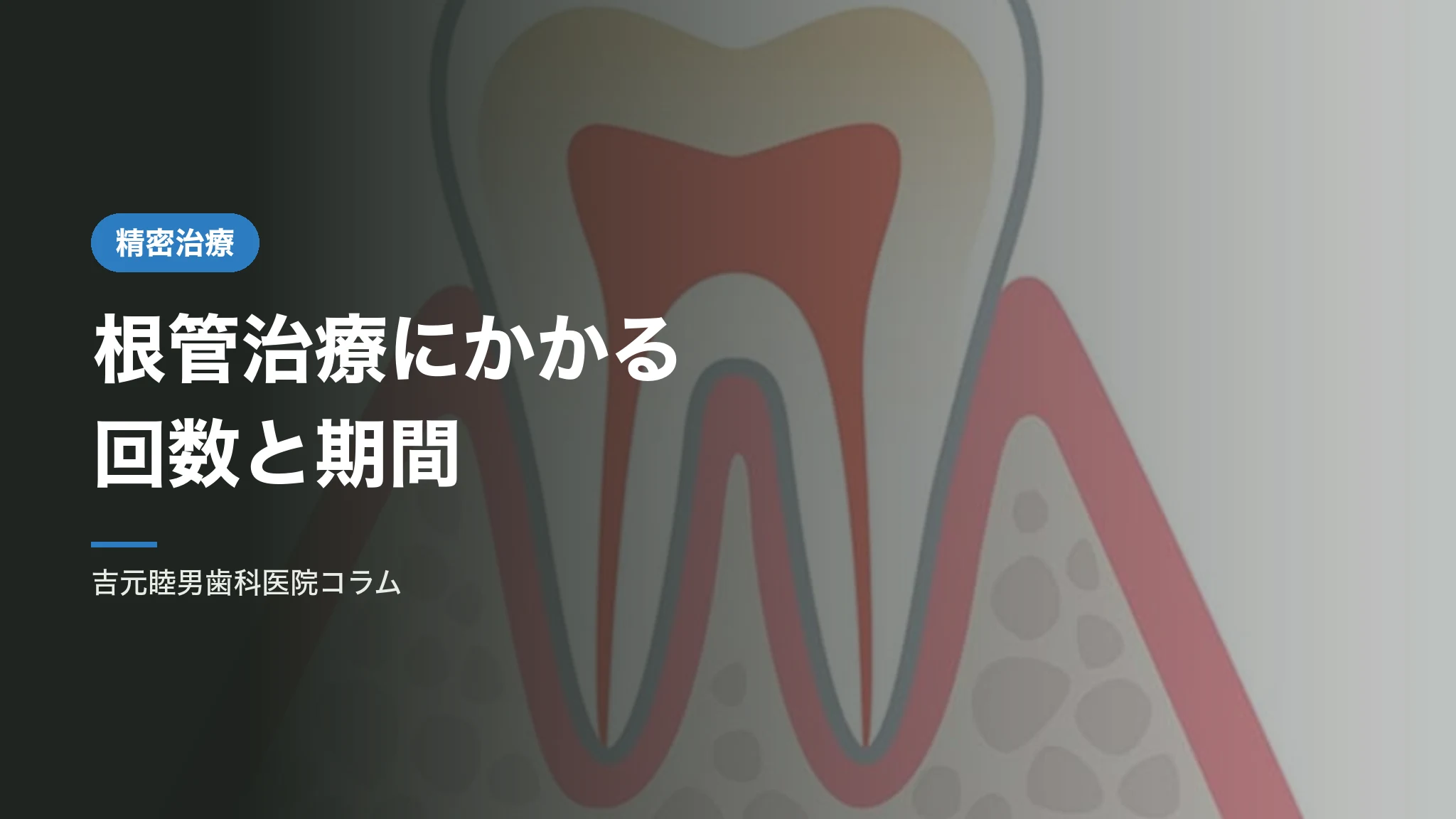 根管治療にかかる回数と期間
